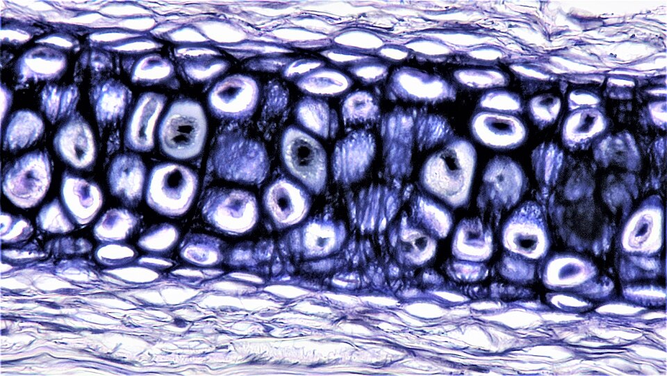 Elastic Cartilage Microscopic View